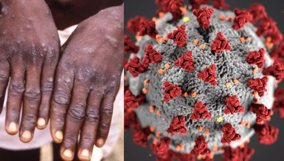 दुनिया के 15 देशों में दस्तक दे चुका Monkeypox जानिए कितना है खतरनाक ? WHO ने चेताया, कहा- कोरोना और मंकीपॉक्स बड़ी चुनौती